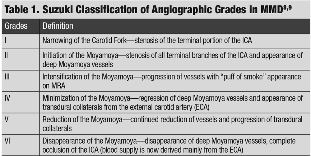 Table 1. Suzuki Classification of Angiographic Grades in MMD