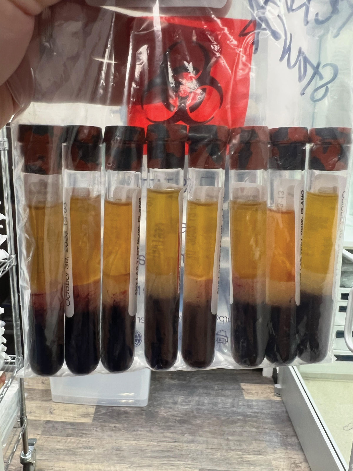 Typical batch of tiger tubes showcasing natural variation in color. Tubes are examined under a bright light to ensure quality of serum. Some tubes may not be used due to the visible presence of red blood cells in the serum layer (second tube from the right).