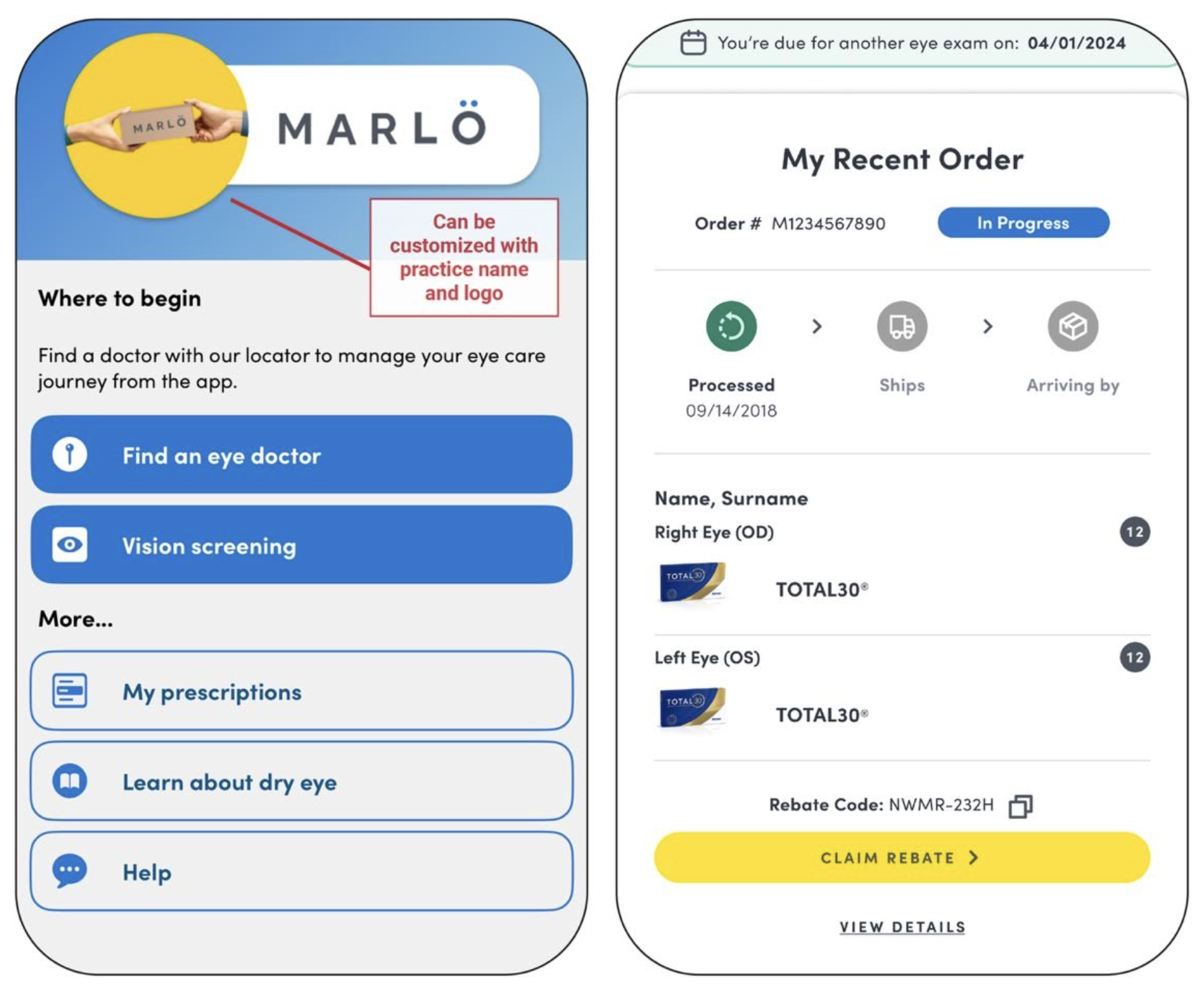 A snapshot of the Marlo app, which allows patients to order contact lenses virtually from their ECP.