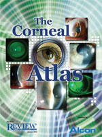 The 2012 Corneal Atlas