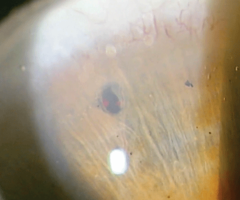 After two shots, the impact of the laser is clearly visible 