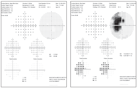 What information can be gleaned from this patient’s visual fields?