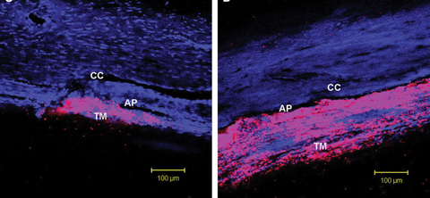 Rho-kinase inhibitors appear to lower IOP by inducing cellular relaxation and disrupting focal adhesions in the TM and the endothelial lining of Schlemm’s canal. Photo: Patrick A. Scott, OD, PhD