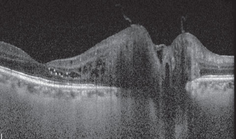 Fig. 3. What can be gleaned from this OCT scan of the optic nerve and macula?