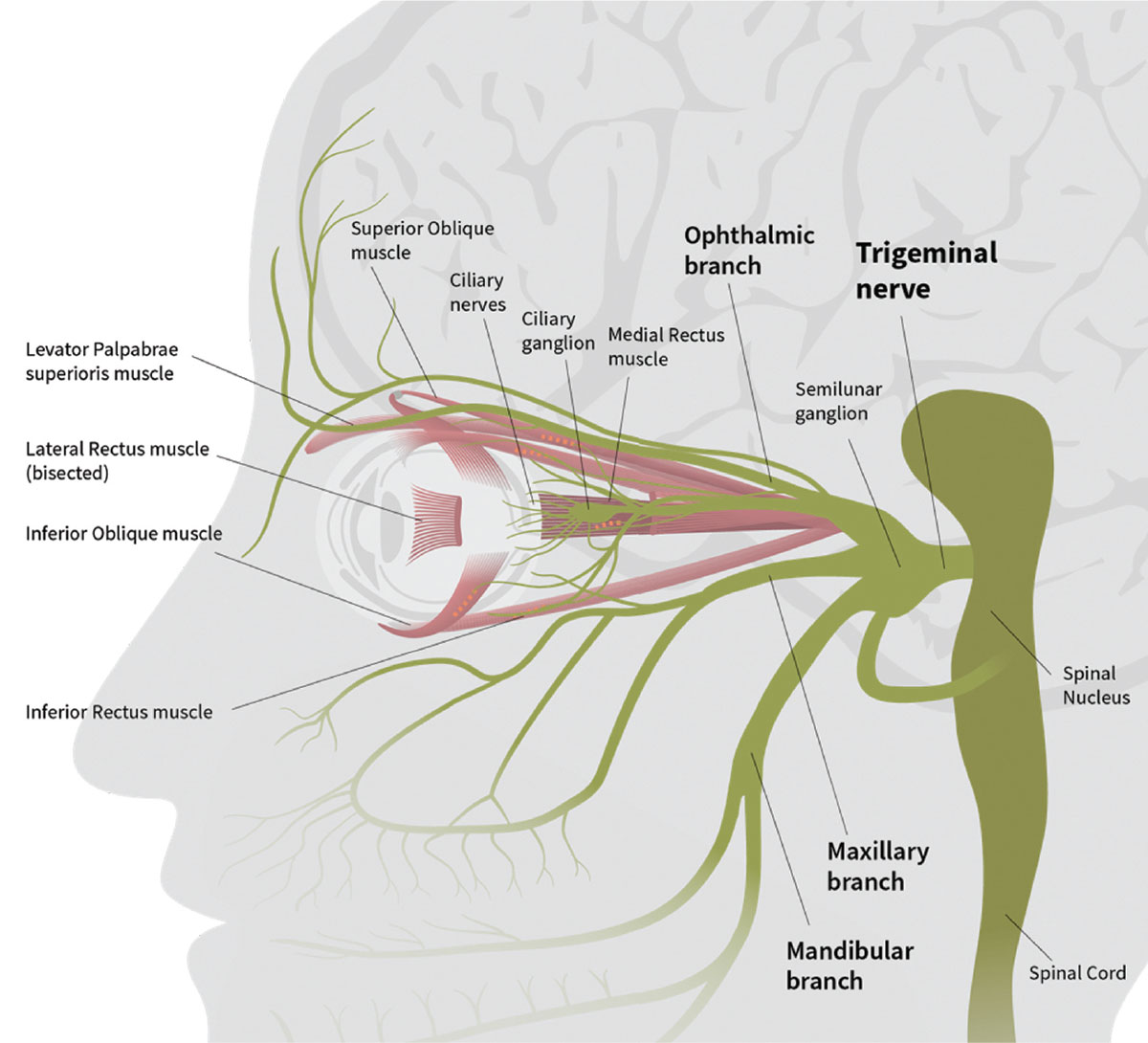 Research now suggests specialized lenses can help patients overcome symptoms of dysfunction of the ophthalmic branch of the trigeminal nerve, trigeminal dysphoria.
