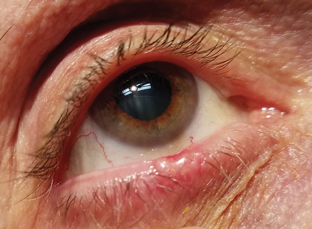 A Close Look at Common Lesions
