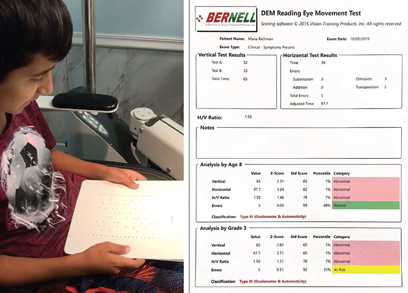 A pediatric patient takes the DEM test (left). This sample of the reading eye test’s results note oculomotor dysfunction and reduced attention (right).