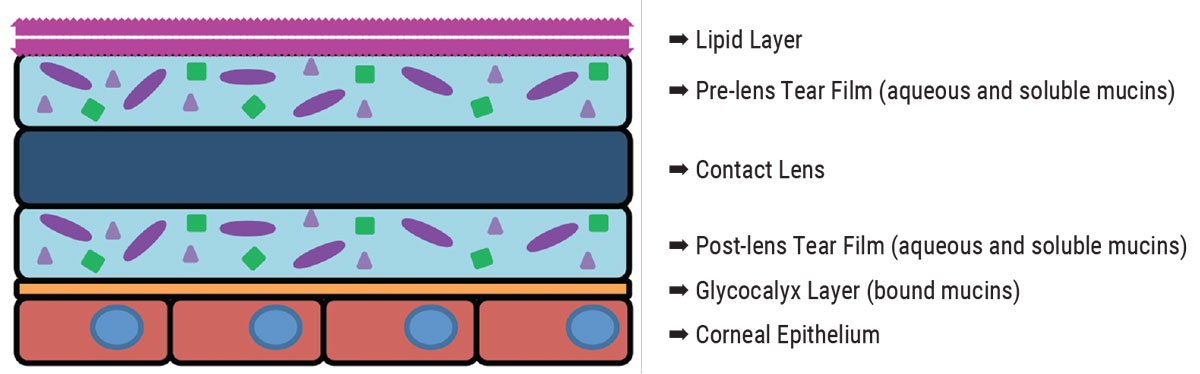 Fig. 1. A contact lens splits the tear film into pre-lens and post-lens layers with different components. 