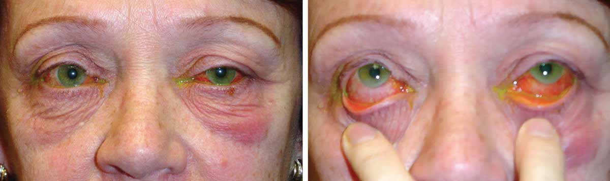 How our patient presented at the clinic. What do these images suggest about her condition?