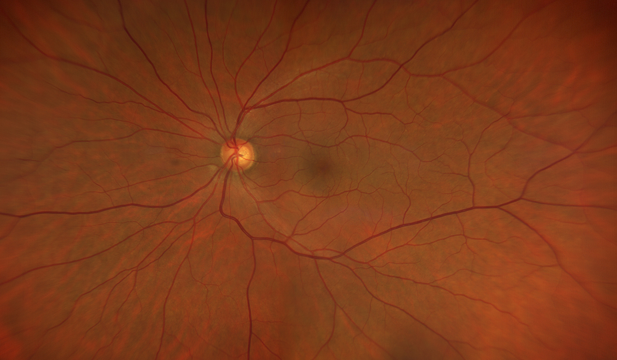 Retinal age may be able to predict lifespan.