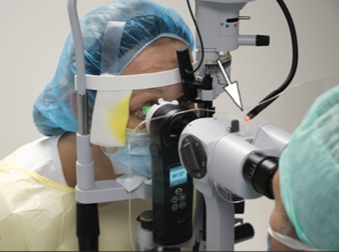 The C-Eye by Emagine AG performs crosslinking on the patient at the slit lamp.