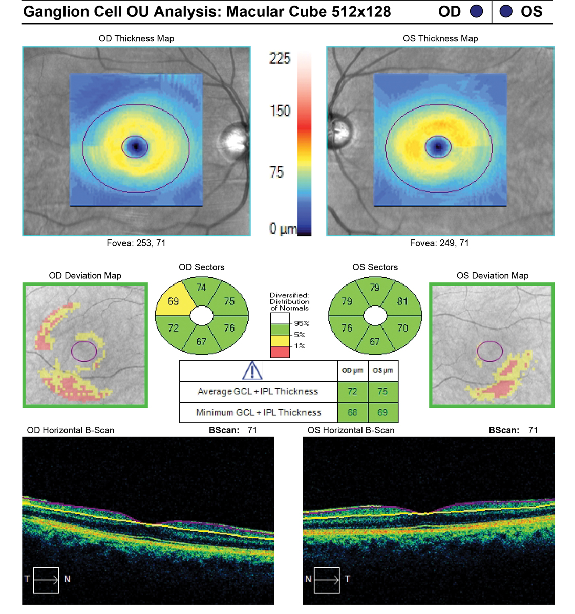 The full macular cube scan might prove more beneficial for diagnosing nonglaucomatous macular pathologies.