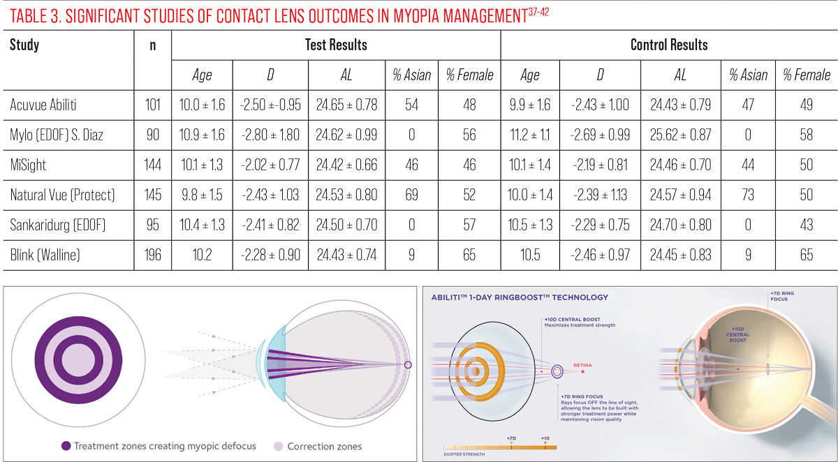 Both the Misight and the Acuvue Abiliti lenses seem to use the same alternating zones approach but, in fact, there are differences in the way they generate, and the level of, their respective myopic defocus (coaxial power and ring boost).