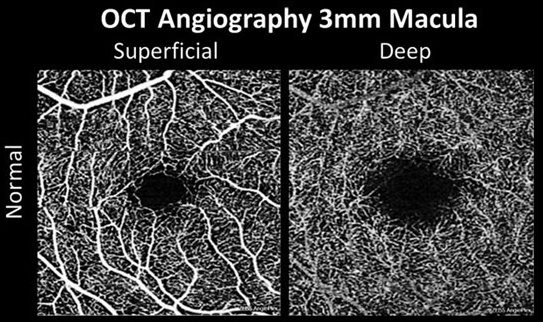 Neither RLRL nor 0.01% atropine appeared to change retinal thickness in premyopic children in this study, but differing effects on the vasculature were noted. Additionally, both treatments prevented myopic shift and axial elongation. 