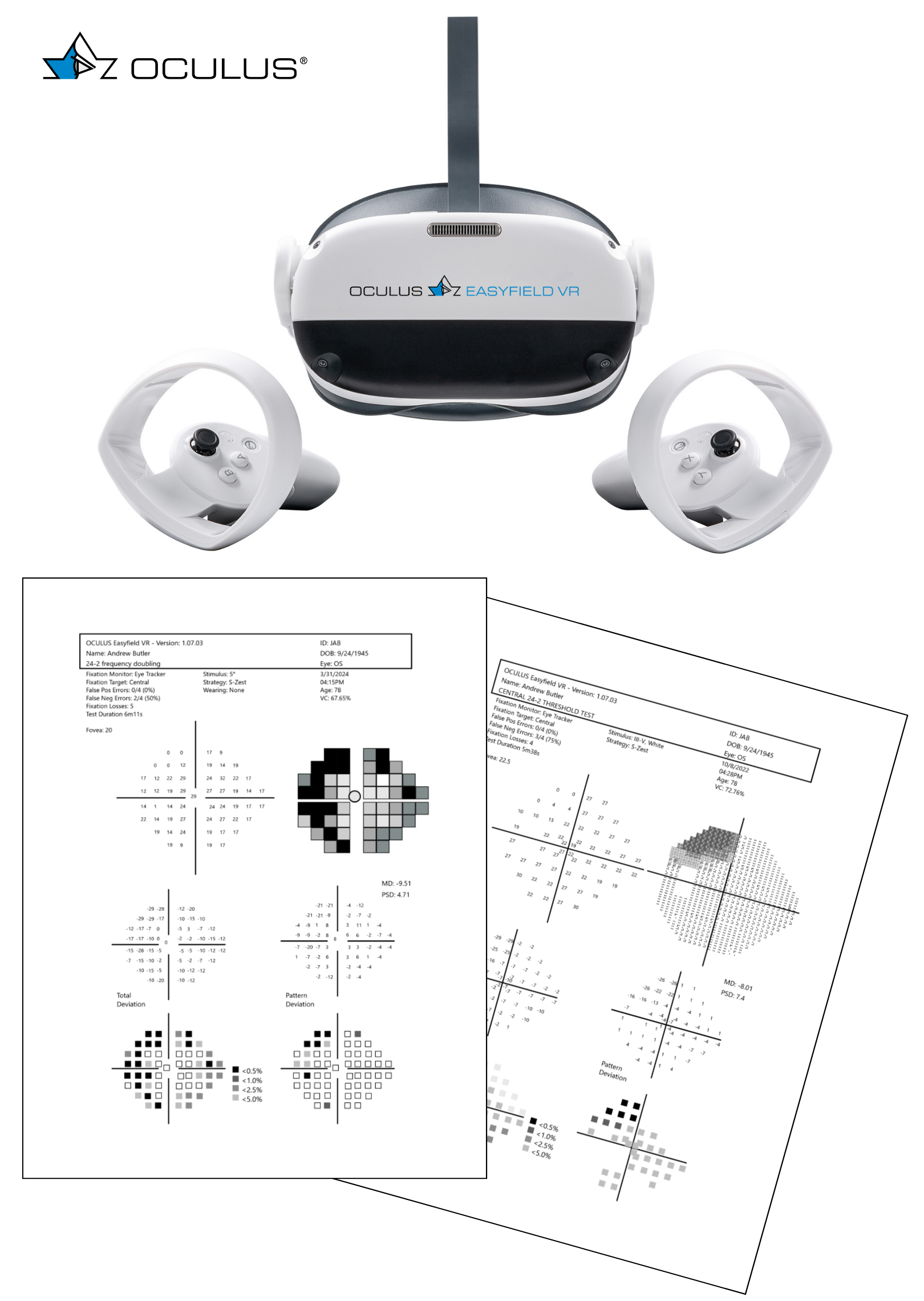 The Easyfield VR headset from Oculus can now perform both SAP and FDP to assess visual field.