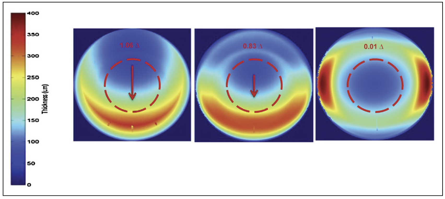 Fig. 1. Thickening of lens zones in three various types of toric stabilization: prism-ballast (left), peri-ballast (center), thin zone (right).