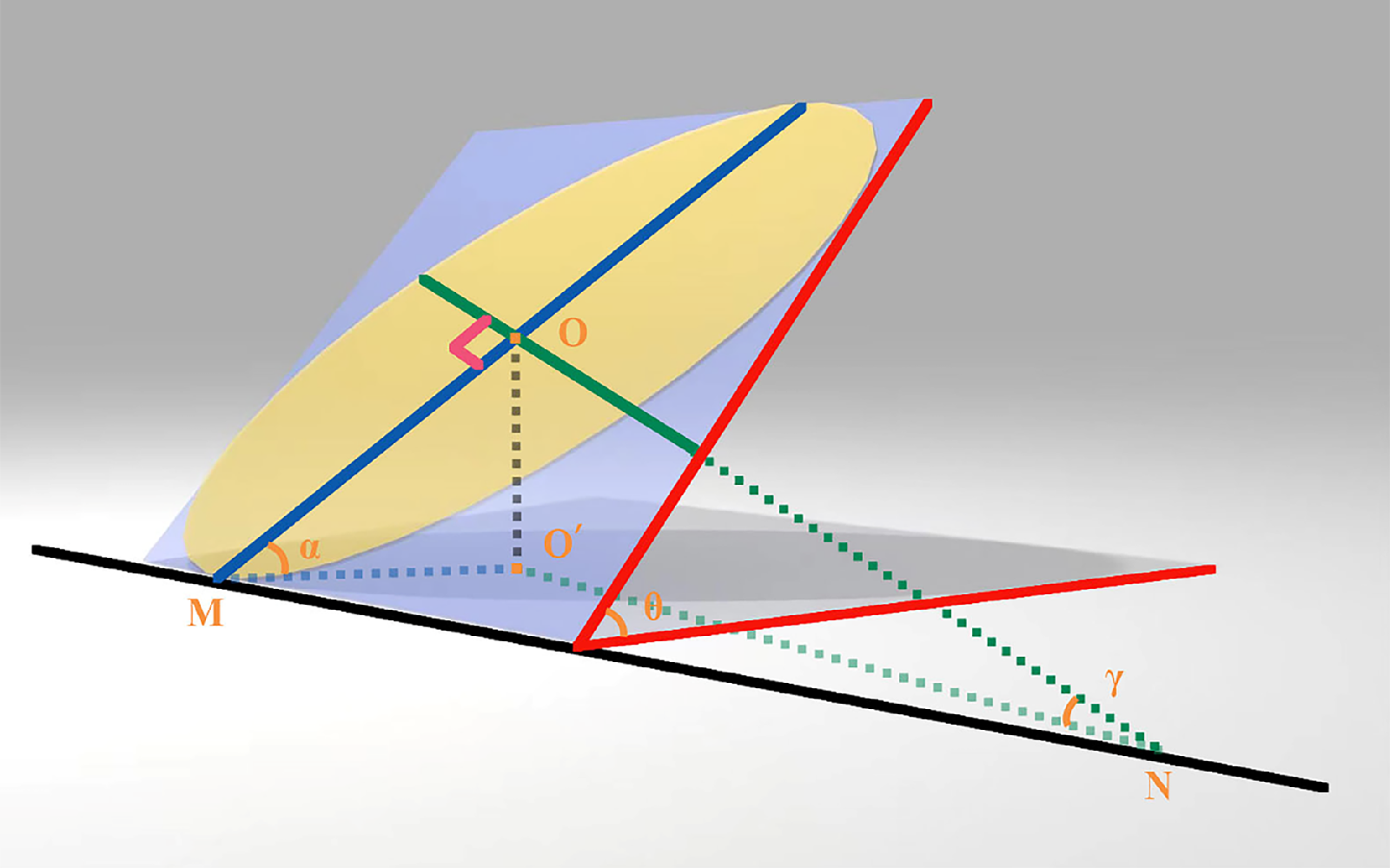 A recent study revealed a more tilted optic disc tended to be associated with a longer AL. Considering the connection between deformations of the optic disc and peripapillary region and the scleral extension on the posterior eyeball segment during the axial growth of myopic eyes, this novel tilted optic disc measurement can contribute to further exploring potential pathologic changes caused by myopic-related axial extension. This image from the study shows a diagram of how discs were measured: the “ovality” of the disc (yellow oval) and the angle formed between the disc plane and coronal plane (red angle) were both measured and then correlated with RNFL values. The blue line represents Bruch’s membrane opening. 