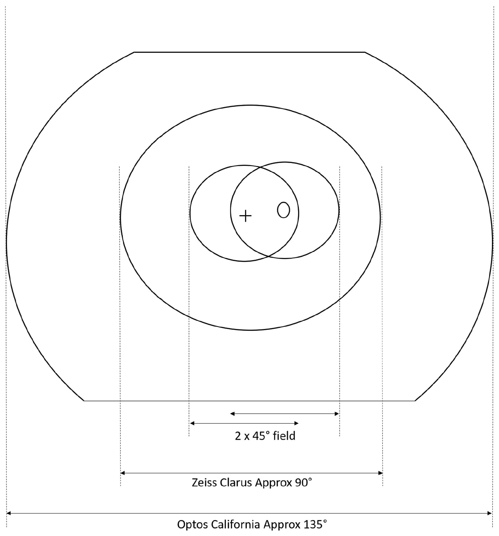 Though they don’t achieve the field of view and stereopsis of a dilated exam, both ultra-widefield imaging cameras evaluated in this study improved upon conventional nonmydriatic imaging that uses either one or two 45° fields in a screening program.