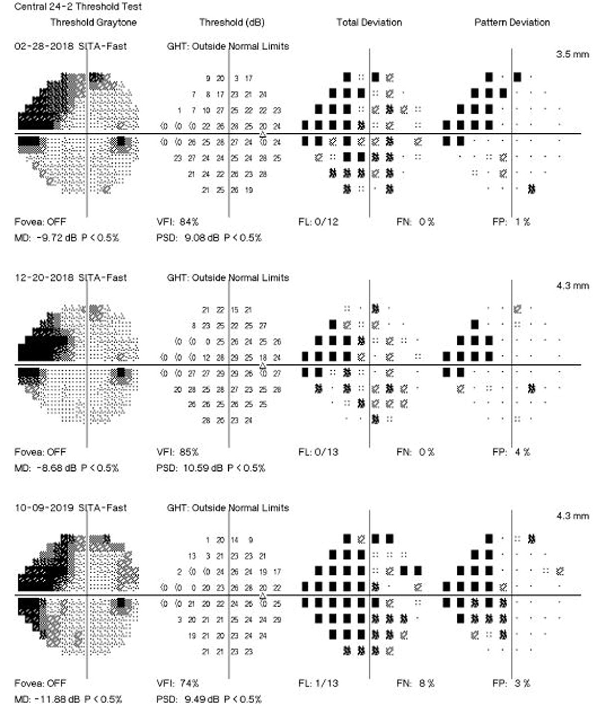 Malnutrition in some low-BMI glaucoma patients removes the antioxidant protections conferred by certain vitamins, researchers propose.