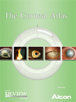 The Corneal Atlas 2013: Part 2 of 2