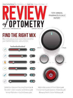 solforex review of optometry
