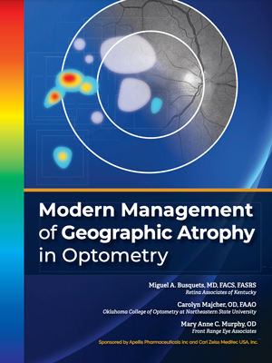 Modern Management of Geographic Atrophy in Optometry