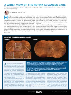 A Wider View Of The Retina Advances Care
